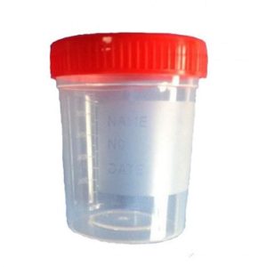 Bote de Orina 100 cc